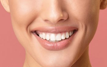 What You Need to Know About Dental Bleaching or Whitening