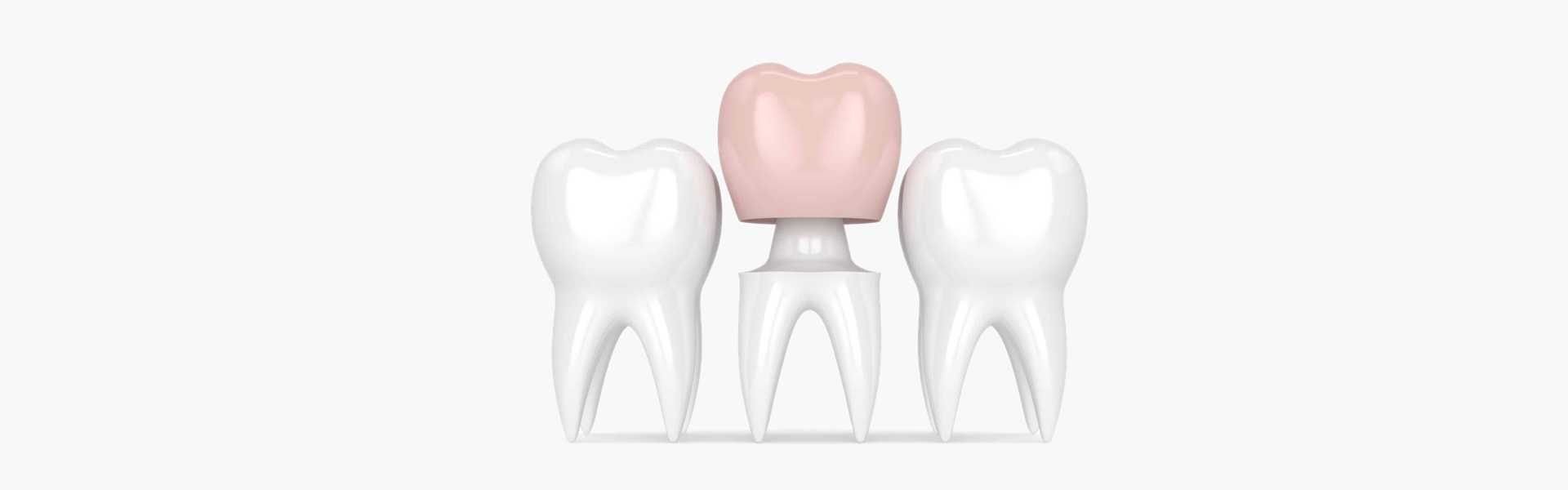 How Dental Crowns Makes You Better?